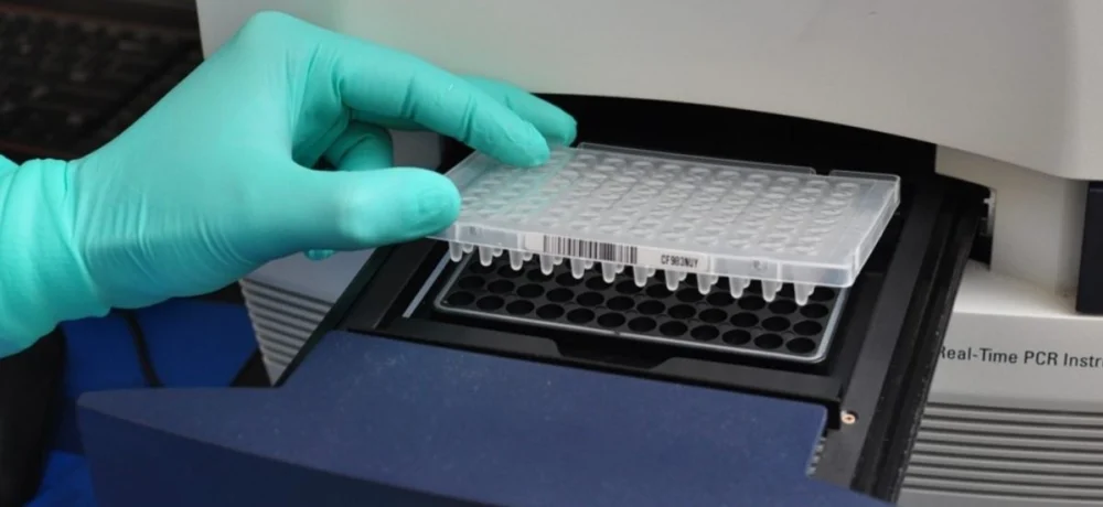 واکنش زنجیره ای پلیمراز (real time pcr)