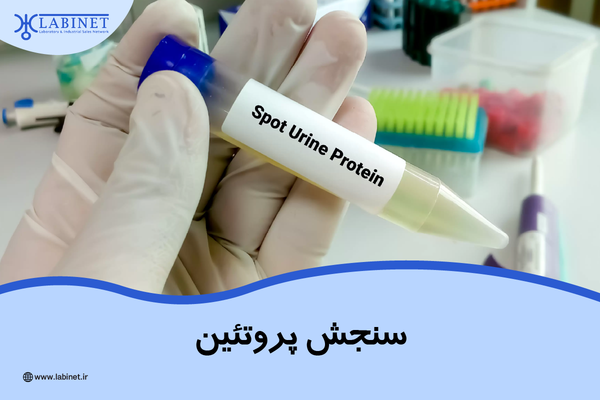 سنجش پروتئین چیست؟
