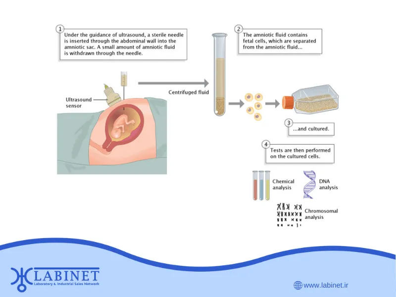 کاریوتایپ پیش از تولد (Prenatal Karyotyping)